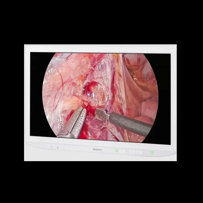 Sony LMD-43M1MD 4K Surgical Monitor